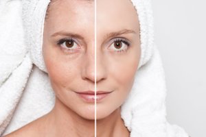 Tiks visiems: 6 triukai, padėsiantys išlaikyti jaunatvišką odą