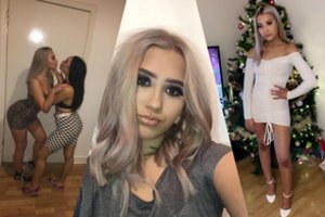 Škotijoje užgeso žinomos 18-metės šokėjos gyvybė