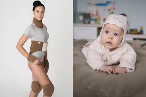 Chirurgas atkreipė dėmesį į teigiamas vilnos savybes: nauda begalinė