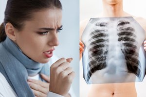 Lietuvoje sparčiai plinta pavojinga liga: vienas žmogus gali užkrėsti 25