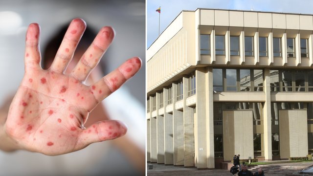 Tymai pasiekė ir Seimą: parlamentaras šia liga įtaria susirgęs Ukrainoje