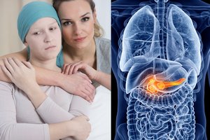 Sergantiems kasos vėžiu – viltinga mokslininkų žinia