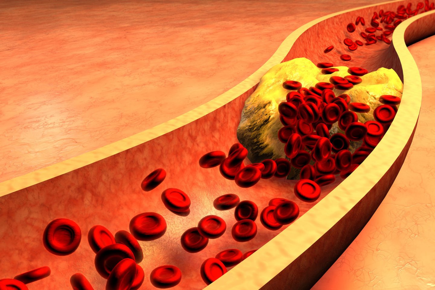  Migdolai yra vieni iš 5 veiksmingiausių produktų, mažinančių „blogojo“ cholesterolio kiekį.<br> 123rf nuotr.