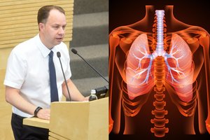 Paaiškėjo, kokie požymiai išdavė A. Verygą užklupusią klastingą ligą: įspėja saugotis