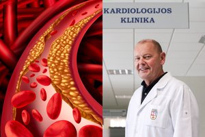 Visa tiesa apie cholesterolį: kaip jis iš tiesų veikia mūsų sveikatą?