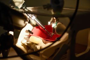 Gera medikų žinia lietuviams: mirtinai pavojingą ligą gydys nauju būdu