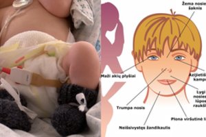 Girti gimę kūdikiai: kaip vėliau klostėsi likimai