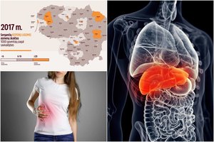 Atskleidė, kur Lietuvoje yra didžiausias sergamumas kepenų ligomis ir kas dėl to kaltas