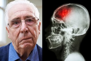 8 priežastys, dėl kurių gali ištikti insultas