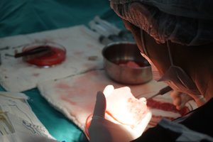 Dėl šių procedūrų į Turkiją važiuoja būriai turistų: štai kaip jos vyksta iš tiesų