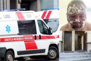 Buvęs krepšininkas atskleidė šeimos dramą: karštas aliejus tapo baisiu žmonos ginklu