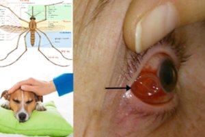 Perspėja: plinta mirtina šunų liga, kirmėlė aptikta ir lietuvio akyje