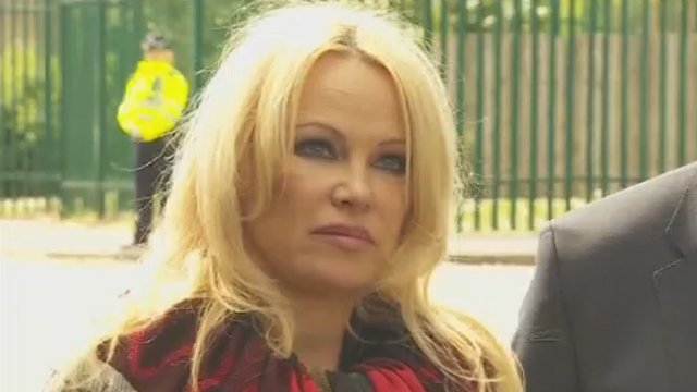 Serialo „Gelbėtojai“ žvaigždė Pamela Anderson kreipėsi į pasaulį su prašymu