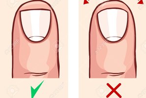 Viena klaida kerpant nagus gali baigtis sunkia infekcija