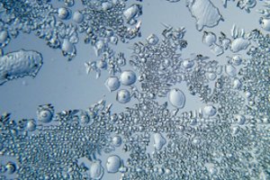 Ieškos galimybių kompensuoti nuostolius sodininkams dėl šalnų