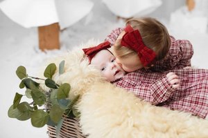 Spaudžia širdį: emigrantų dukrelei nuo žaizdų dantenos suaugo su lūpomis