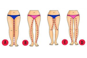 Moters kojų forma išduoda jos elgesį lovoje