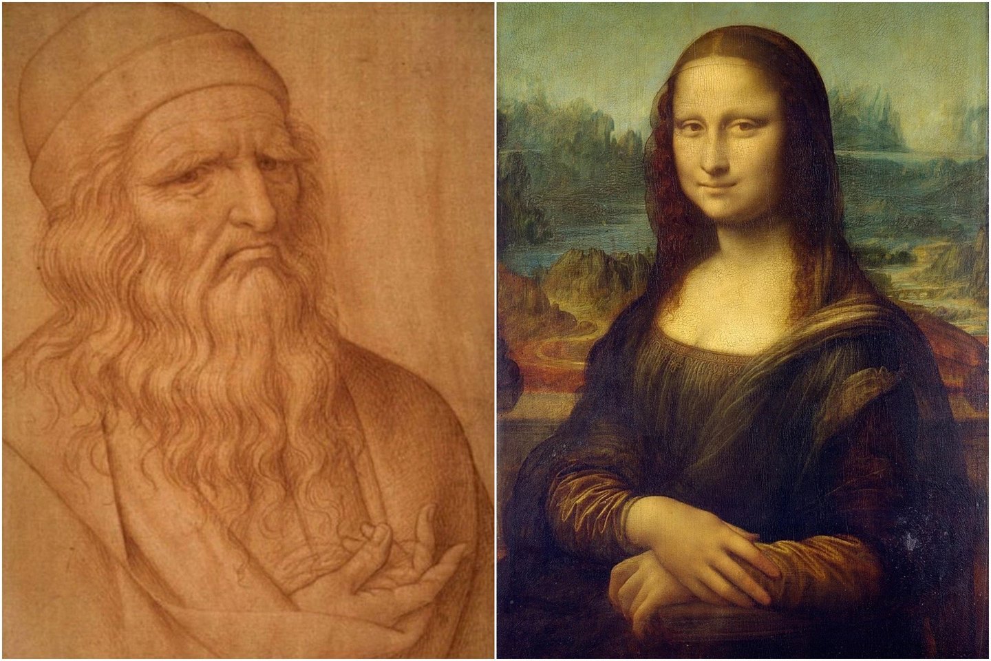 Alkūninio nervo suspaudimas“gali paaiškinti, kodėl jis paliko tiek daug neužbaigtų paveikslų, tame tarpe – ir „Moną Lizą“.<br> Giovanni Ambrogio Figino / Leonardo da Vinci pav.