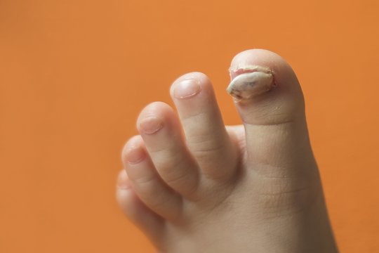 Lengvai užkrečiama liga gresia baisiomis pasekmėmis: lietuviai daro esminių klaidų