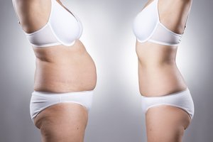 Jogurtas padės sulieknėti: venkite vienintelės klaidos