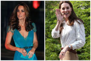 Pleistrai ant Catherine Middleton pirštų užminė mįslę: kunigaikštienė slepia žaizdas?