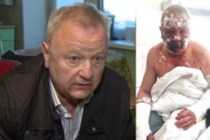 Buvusio krepšininko V. Jurgučio drama: žmona apipylė verdančiu aliejumi