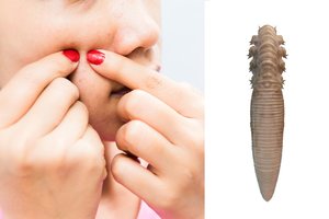 Šokiruojanti tiesa: štai kas iš tiesų veisiasi ant jūsų veido