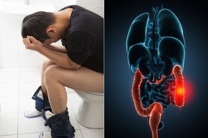 Ši tyli liga nusineša tūkstančius gyvybių: patarė, kam labiausiai reikėtų sunerimti