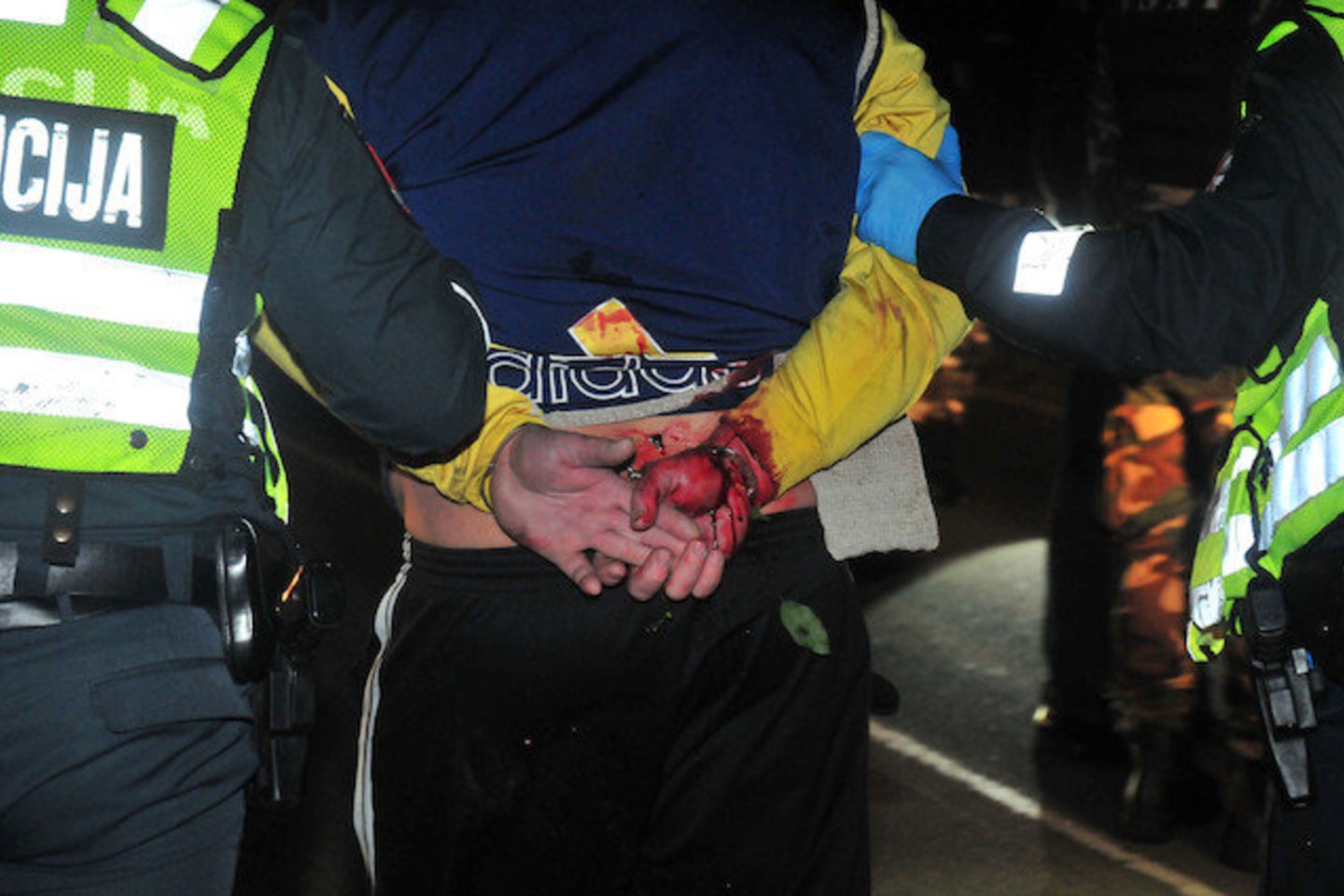 Jurbarko krašto gyventojai prabilo apie svarbių liudininkų sekimą paauglės sužalojimo ir pasikėsinimo ją išžaginti byloje.<br> Lrytas.lt asociatyvioji nuotr.