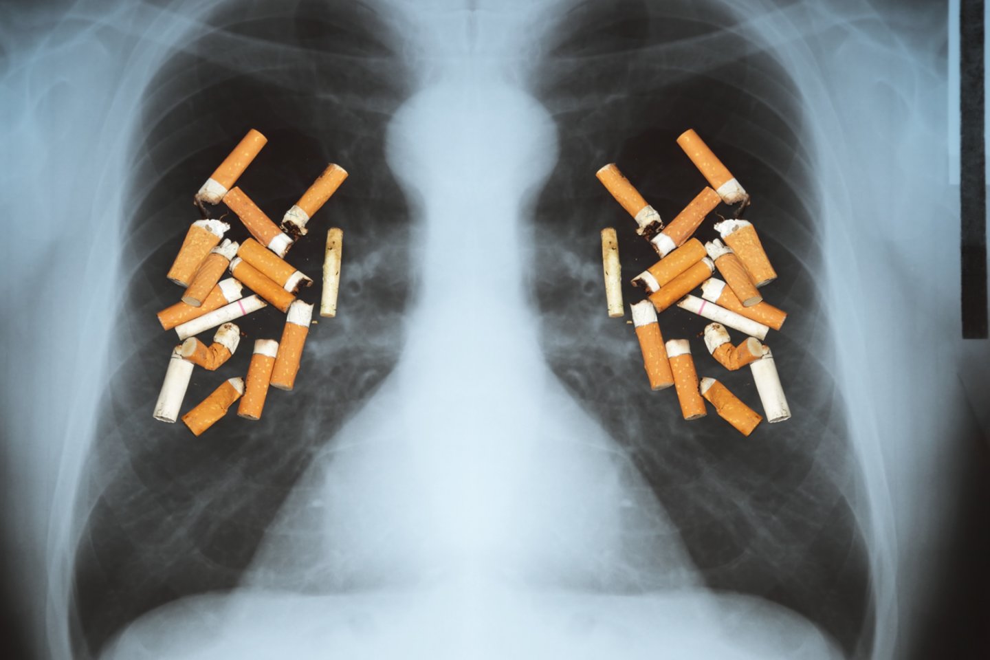 Su rūkymu siejama daug vėžio formų,taip pat širdies ir kraujagyslių bei kvėpavimo takų ligos.<br> 123rf nuotr.