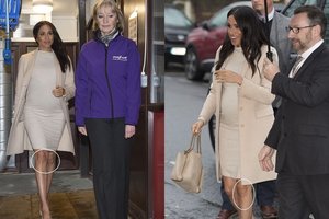 Pasaulis kraustosi iš proto: šįkart apkalbų centre – Meghan Markle kūno anomalija 