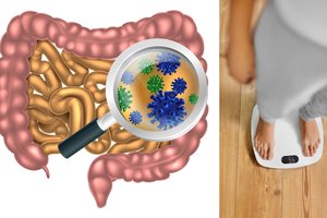 Suapvalėjusios figūros ir nusilpusio imuniteto priežastis gali slypėti žarnyne