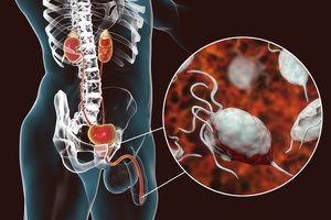 Kasdien diagnozuojama 1 mln. naujų susirgimų lytiškai plintančiomis ligomis