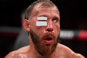 MMA kovoje Čikagoje T. Fergusonas varžovo veidą sudarkė neatpažįstamai 