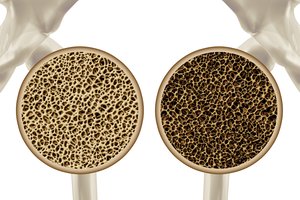 Atskleista, koks sūris geriausias vyresniems žmonėms: šis produktas – tikras stebuklas kaulams ir sąnariams