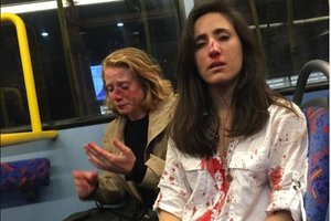 Prabilo autobuse užpulta lesbiečių pora: „Mums siūlo išvykti iš šalies“