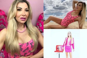 48-erių gyva Barbė muša operacijų rekordus ir neketina sustoti: „Noriu atrodyti amžinai jauna“