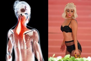 Lady Gaga papasakojo apie kančias, kurias jai sukelia paslaptinga liga