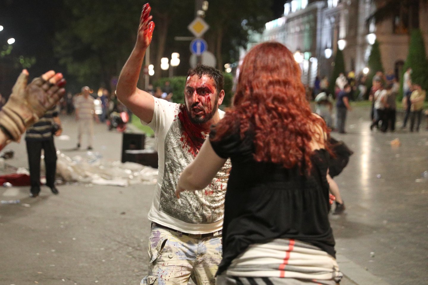 Gruzijos sostinėje praėjusią naktį per neramumus buvo sužeisti daugiau kaip 200 žmonių, pusė jų vis dar gydomi ligoninėse.<br>Reuters/Scanpix nuotr.