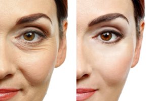 Papilkėjusią odą ir nušiurusius plaukus pamiršite pasinaudoję keliais paprastais patarimais