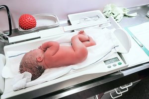 Neleidus atlikti aborto kūdikis gimė be kaukolės ir smegenų