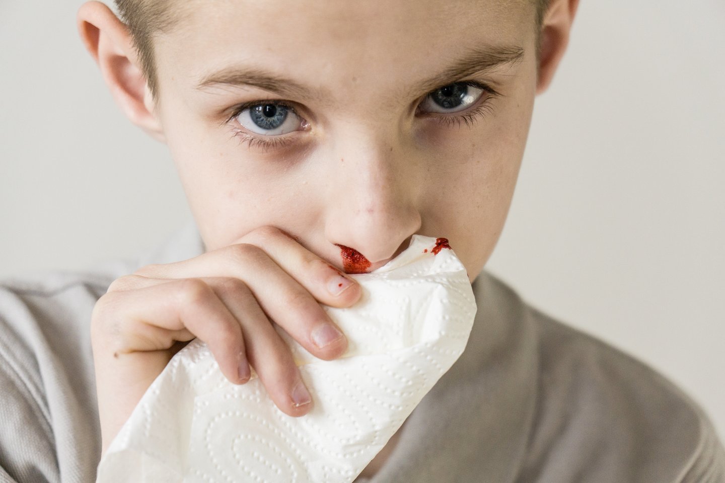 Kraujavimas iš nosies gali atrodyti kaip gan menkas negalavimas, tačiau jis niekada neištinka be priežasties ir dažnai yra kokio nors negalavimo, kartais ir labai rimto, simptomas.<br> 123rf nuotr. 