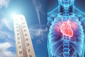 Kardiologė šiurpsta dėl kai kurių lietuvių elgesio per karščius: gresia dideli nemalonumai