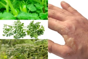 Prie šių augalų geriau nesiliesti: ne tik nudegins, bet ir sukels mirtiną pavojų