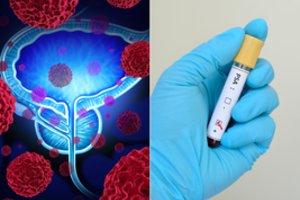 Šia vyrus šienaujančia liga susirgs 1 iš 7: yra tik vienas būdas užkirsti tam kelią 