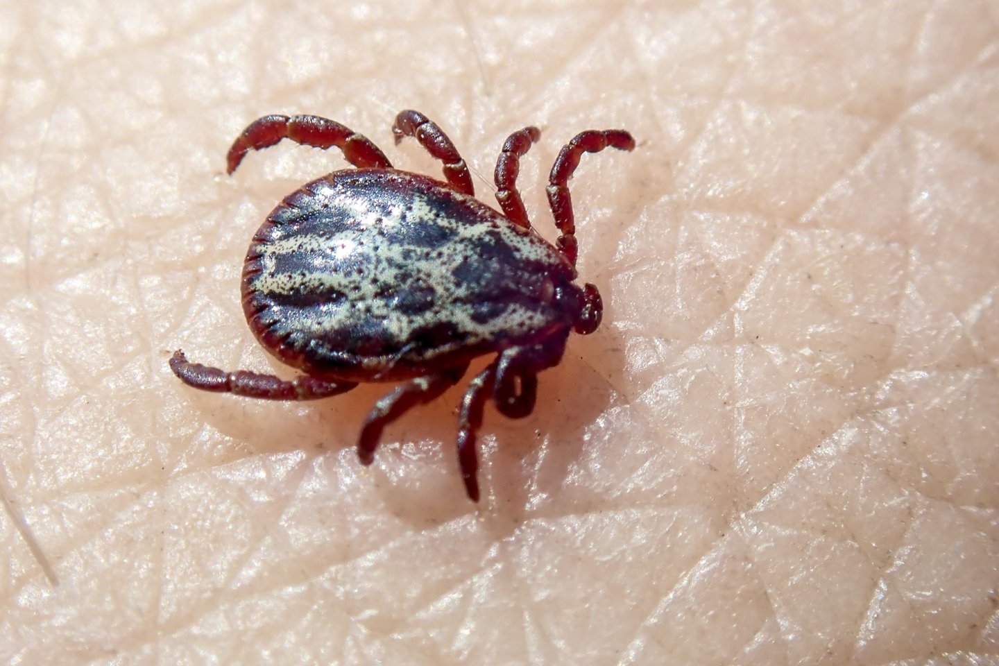 Erkės platina pavojingas ligas. <br>V.Ščiavinsko nuotr.