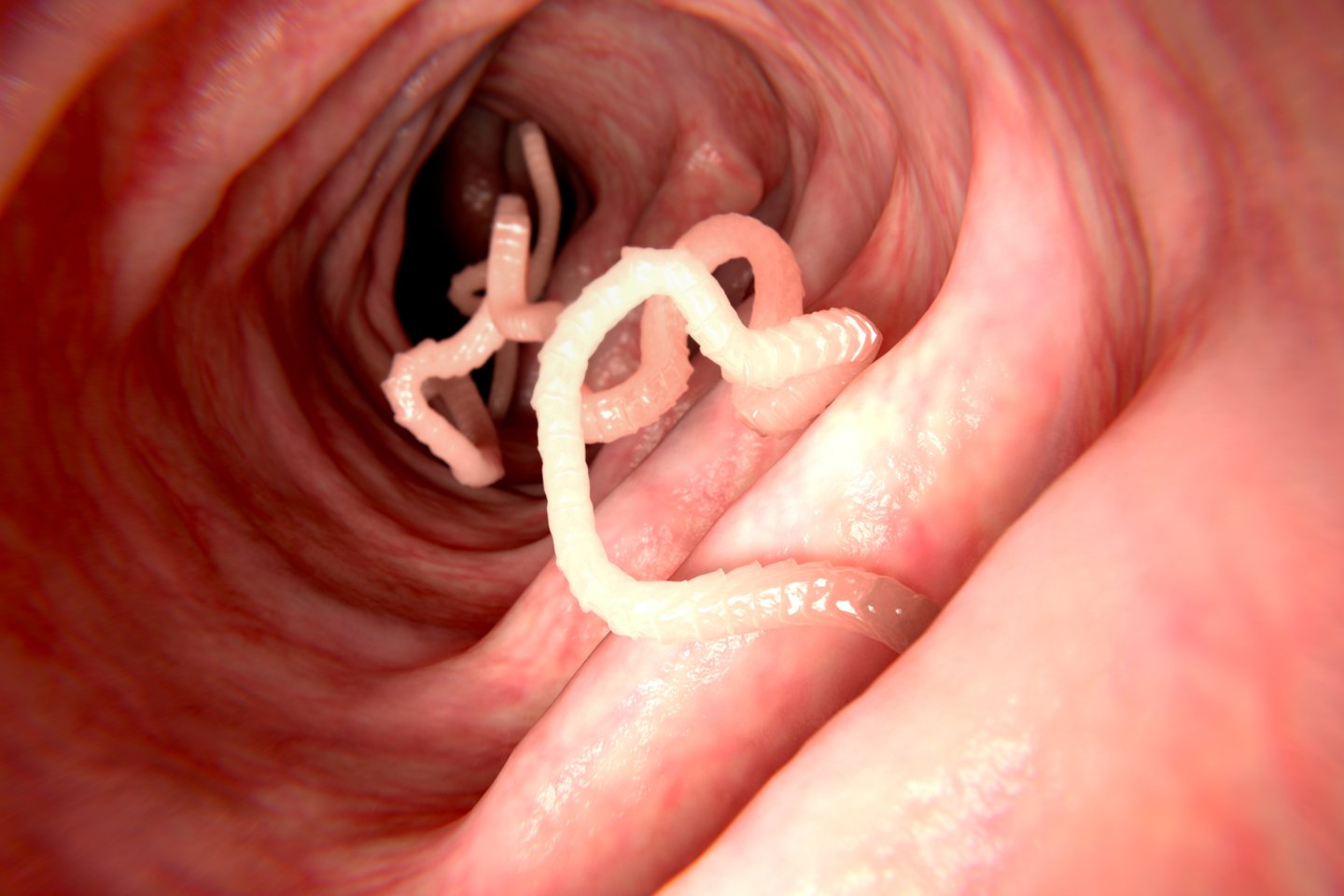 Parazitii intestinali- locatarii nestiuti ai corpului nostru, Trecând paraziți în scaun