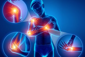 Šie skausmai kamuoja kas penktą vyresnį nei 35-erių metų žmogų: ką daryti?