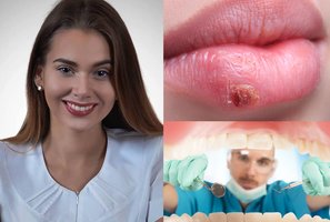 Odontologė įvardijo vieną dažną lietuvių klaidą, kuri gresia komplikacijomis