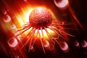 Atsirado vaistas, galintis padėti užkirsti kelią vienai dažniausių piktybinių ligų